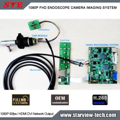 Sistema di imaging per telecamera per endoscopio FHD 1080P